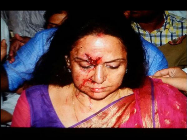 बच्चे की मौत