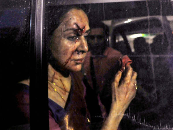 हेमा मालिनी घायल 