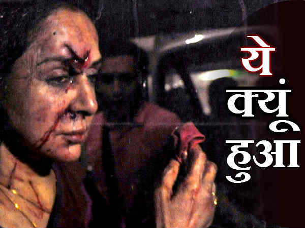 हेमा मालिनी के चेहरे पर गंभीर चोट हेमा मालिनी के चेहरे पर गंभीर चोट