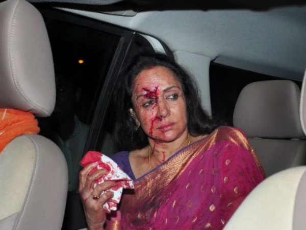 नाक, आंख और पैर में लगी चोट नाक, आंख और पैर में लगी चोट