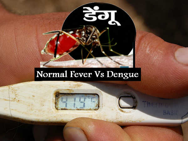 Dengue Vs Normal Fever Dengue Vs Normal Fever