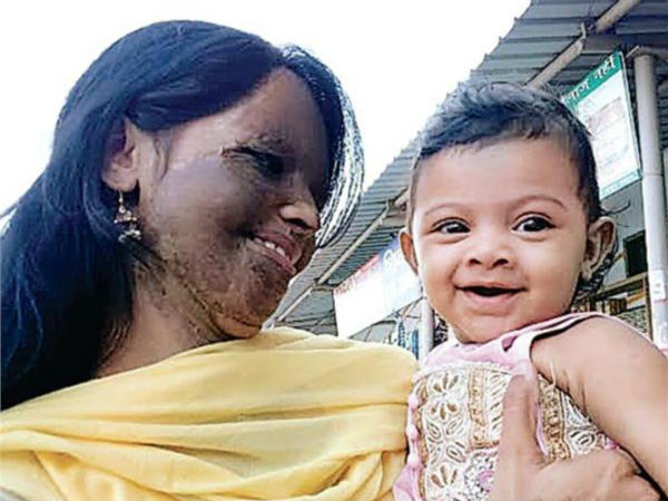  Acid attack victim Laxmi Saa