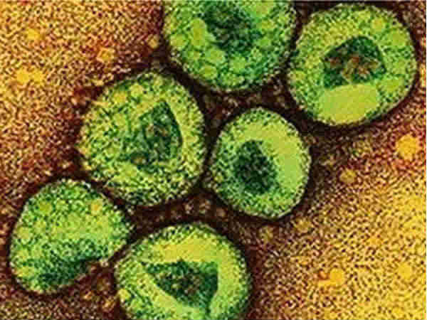 लस्सा वायरस