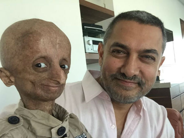  प्रोजेरिया से पीड़ित