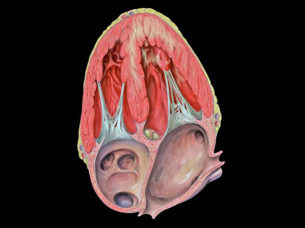 हार्ट अटैक