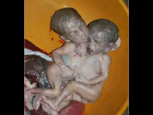 एक घंटा जीवित रहा 