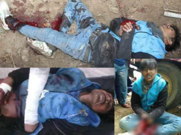 काट डाला हाथ 