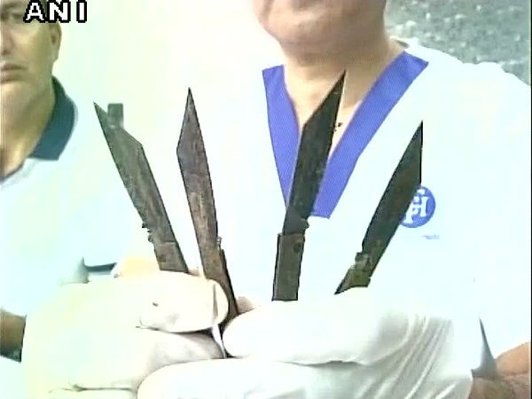 दो महीने से खा रहा था चाकू