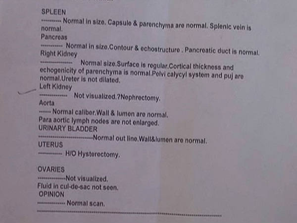 तब दोनों किडनियां थीं