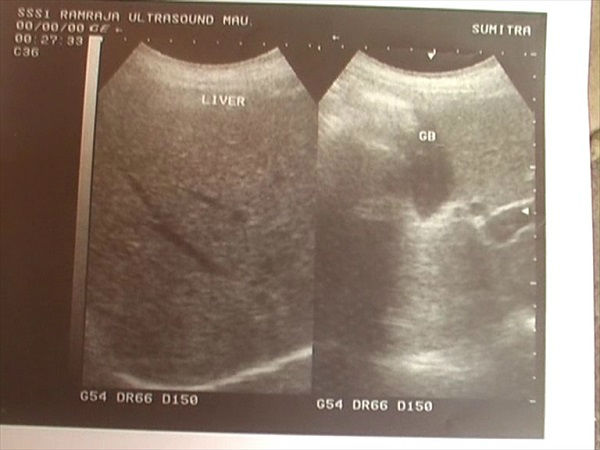 ये है अल्ट्रासाउंड की रिपोर्ट