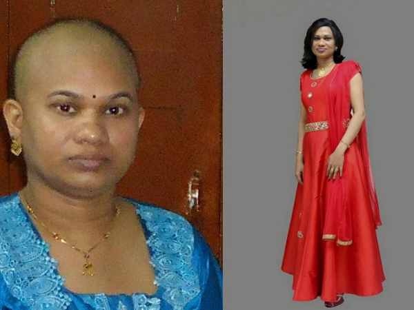 कीमोथेरेपी के दौरान गिर जाते हैं बाल
