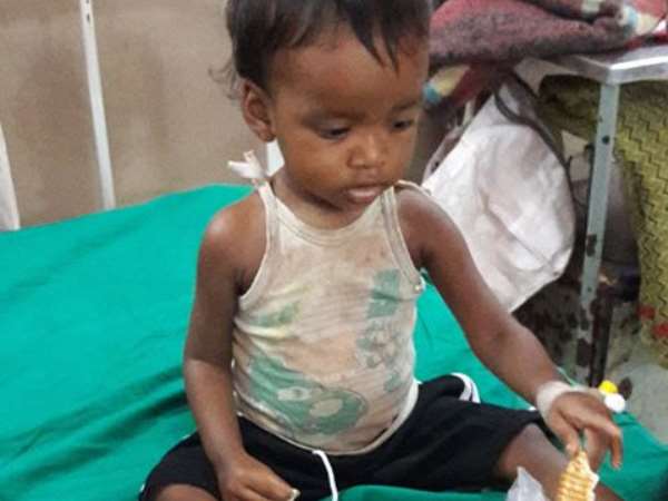 japanese encephalitis2