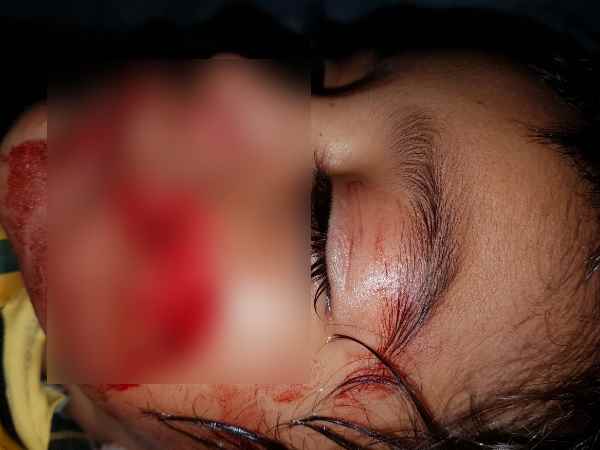 कानपुर चिड़ियाघर की शोभा बनेगा बंदर