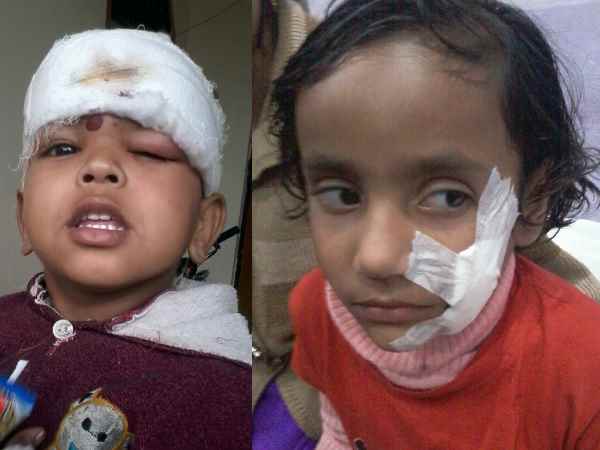 25 से अधिक बच्चों को काट खाया