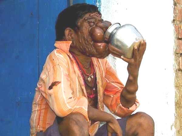  मिल गया न्यूज लायंस क्लब का साथ, अब ठीक होगा मिथुन