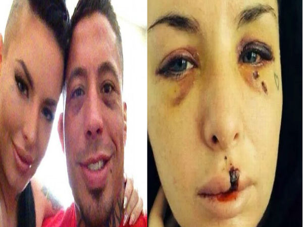 Wrestler sexually assault her girlfriend and beat her badly,18 bones broken Wrestler sexually assault her girlfriend and beat her badly,18 bones broken