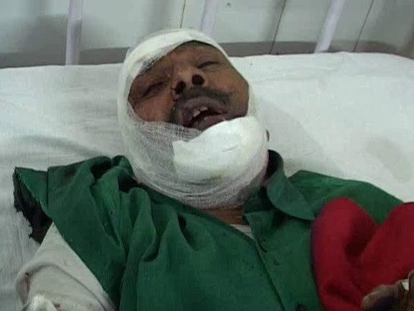 शाहजहांपुर के सदर बाजार थाना क्षेत्र की घटना