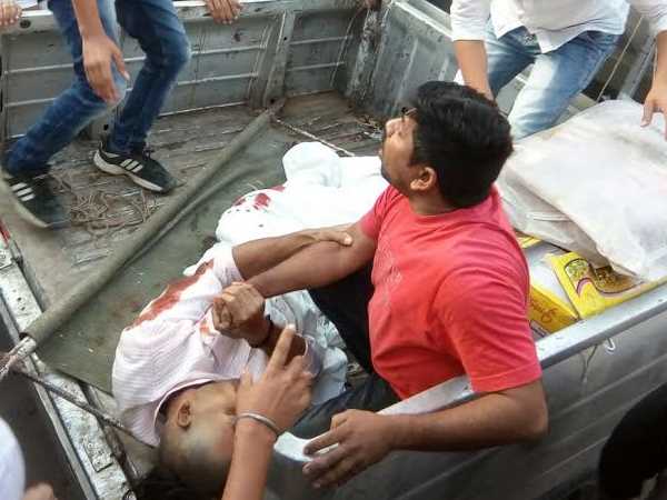 वाराणसी: नो एंट्री में युवक पर चढ़ा ट्रक, कुचल दिया एक पैर वाराणसी: नो एंट्री में युवक पर चढ़ा ट्रक, कुचल दिया एक पैर