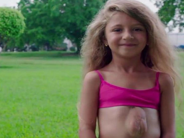 Miracle: The Heart Of This Girl Beats Outside Her Chest Miracle: The Heart Of This Girl Beats Outside Her Chest