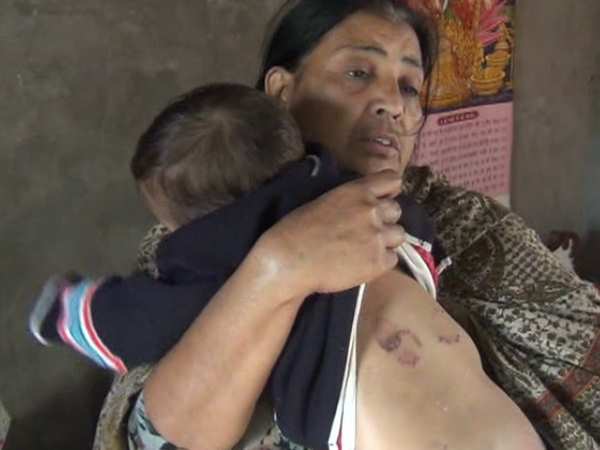 मेरठ: कलयुगी मां ने 11 माह की बेटी को दांतों से काट किया लहूलुहान मेरठ: कलयुगी मां ने 11 माह की बेटी को दांतों से काट किया लहूलुहान