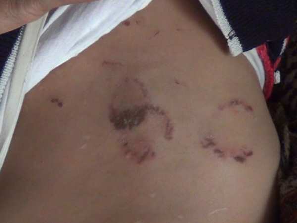 मेरठ: कलयुगी मां ने 11 माह की बेटी को दांतों से काट किया लहूलुहान मेरठ: कलयुगी मां ने 11 माह की बेटी को दांतों से काट किया लहूलुहान