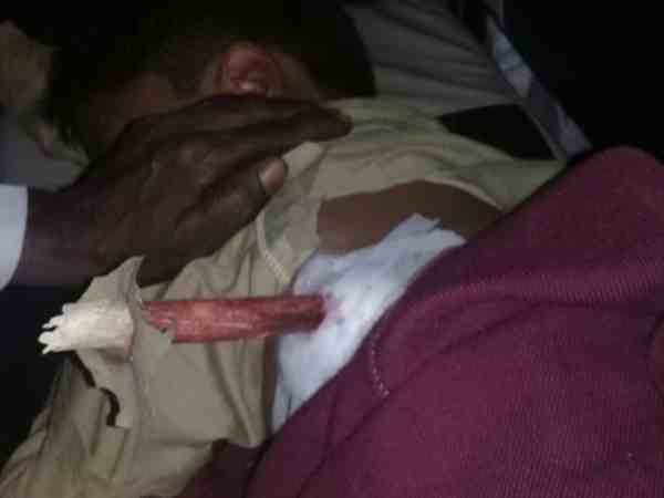 खेल-खेल में सीने में घुस गई लकड़ी, देखिए दिल दहलानेवाला वीडियो खेल-खेल में सीने में घुस गई लकड़ी, देखिए दिल दहलानेवाला वीडियो