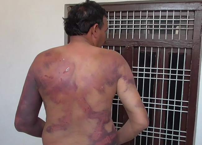 मैनपुरी: अखिलेश के गढ़ में दिखा पुलिस का तांडव, महिला-बुजुर्गों को घर में घुसकर पीटा गया