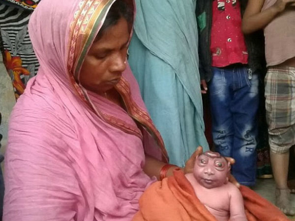 बिना सिर और बड़ी-बड़ी गोल आंखों के साथ पैदा हुआ बच्चा बिना सिर और बड़ी-बड़ी गोल आंखों के साथ पैदा हुआ बच्चा
