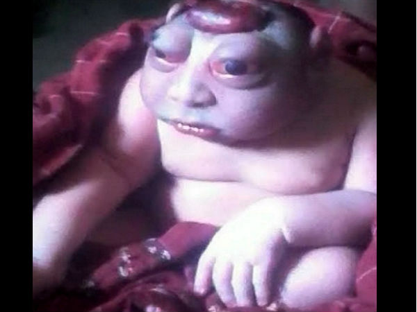 दुलर्भ बीमारी से गुजर रहा है बच्चा दुलर्भ बीमारी से गुजर रहा है बच्चा