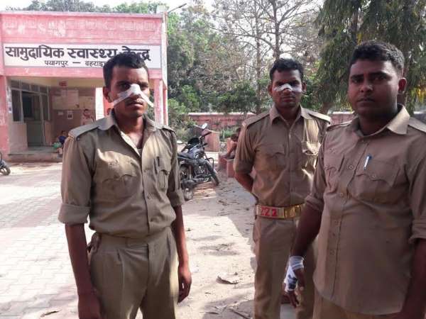 PICS: फॉयर ट्रेनिंग से लौट रहे पुलिसकर्मियों की बस पलटी, 15 जवान घायल