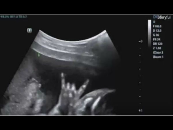 Video: 'Rockstar' child inside womb shows devil's horn in ultrasound Video: 'Rockstar' child inside womb shows devil's horn in ultrasound