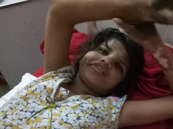 भीड़ देख सहम उठती है मोगली गर्ल
