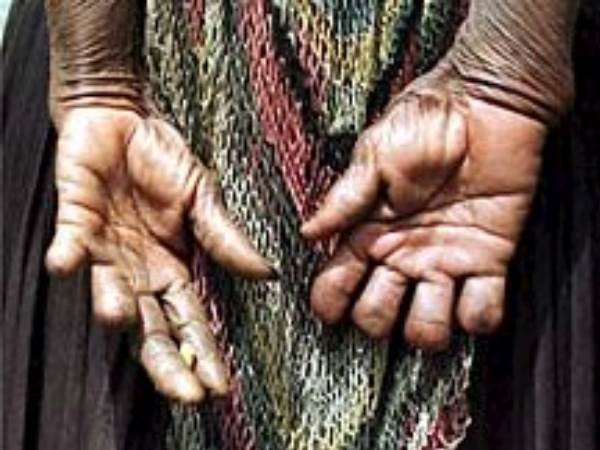 शोक जताने के लिए काटती हैं उंगलियां