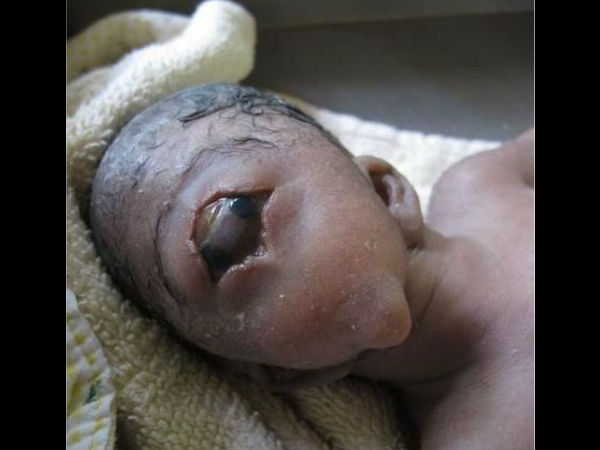  एक आंख और एक कान