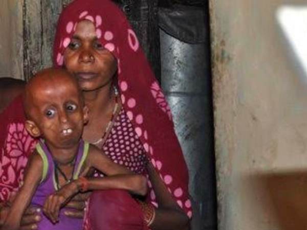 उम्र 21 पर दिखता है बच्चा 
