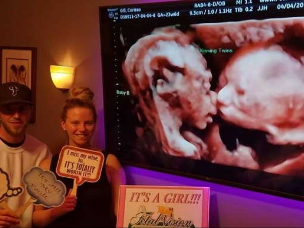 अल्ट्रासाउंड में दिखा गर्भ में प्यार करती जुड़वा बहनों का प्यार, दिल जीत लेगी तस्वीर अल्ट्रासाउंड में दिखा गर्भ में प्यार करती जुड़वा बहनों का प्यार, दिल जीत लेगी तस्वीर