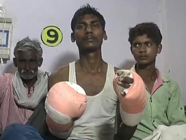 मुरादाबाद: भीख मंगवाने के लिए काटे दोनों हाथ, बेहोश कर किया था अपहरण, देखिए ये तस्वीरें