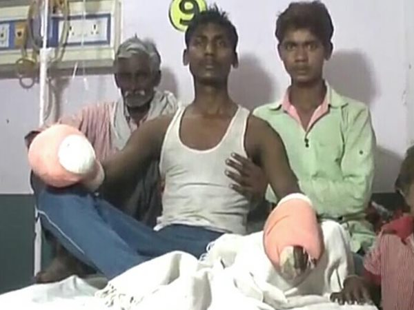 मुरादाबाद: भीख मंगवाने के लिए काटे दोनों हाथ, बेहोश कर किया था अपहरण, देखिए ये तस्वीरें