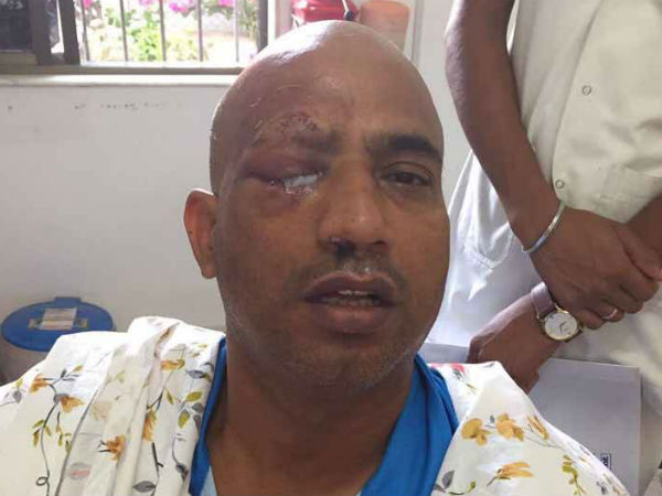 एक्टर जीतू वर्मा की कार पर हमला, जा सकती है एक आंख की रोशनी