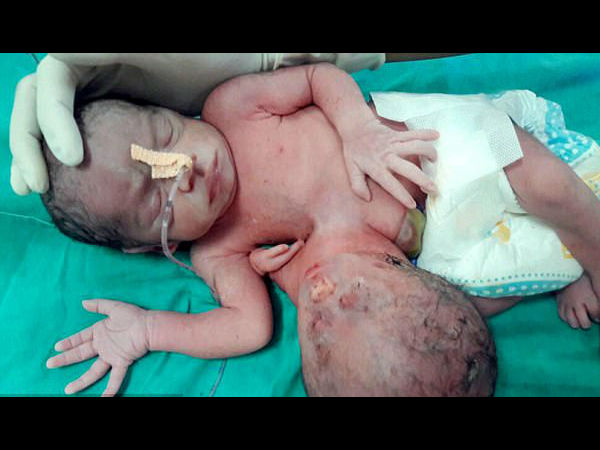  लाखों में से किसी एक को होती है ये बीमारी 