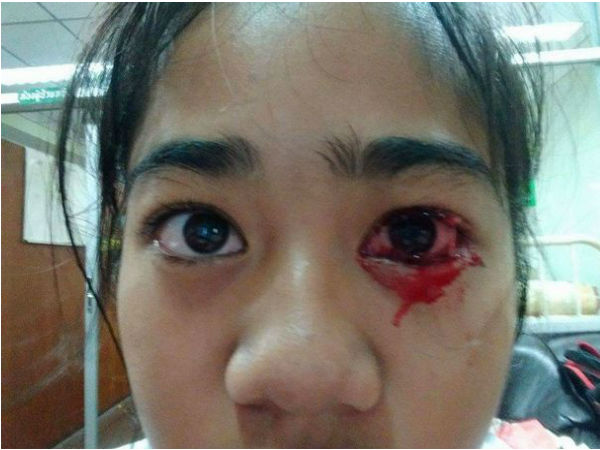  आंख, नाक, कान कहीं से भी निकलने लगता है खून