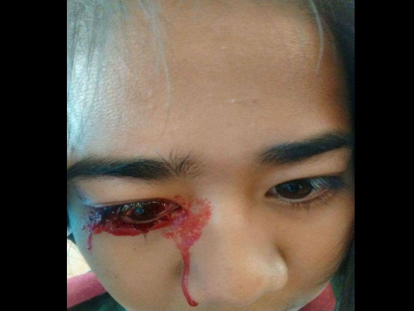  लगातार बहता रहता है खून