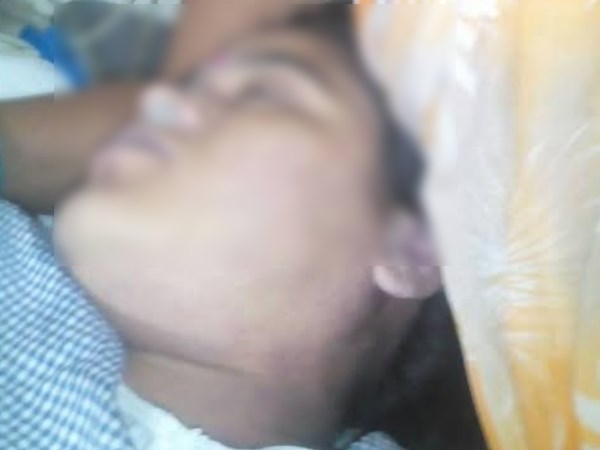 आईसीयू में परिजनों ने देखा, बेजान थी कंंचन