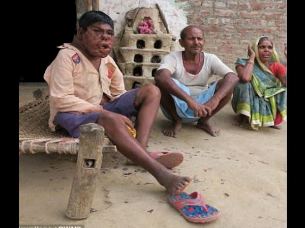  डरावना हो गया है चेहरा 