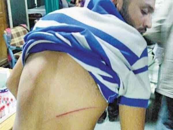 हॉस्टल में छात्रों गुटों के बीच हिंसक झड़प