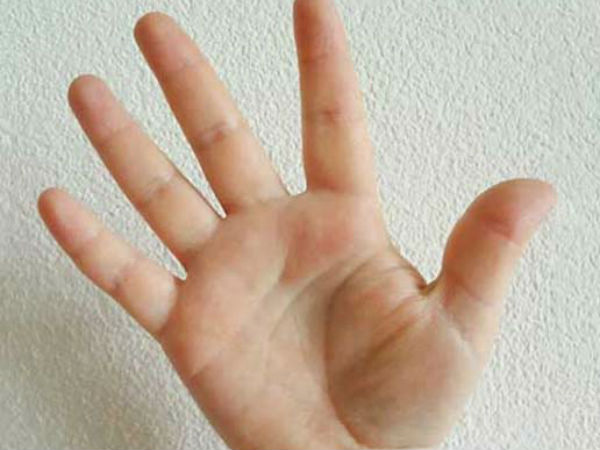 चौड़ी हथेली