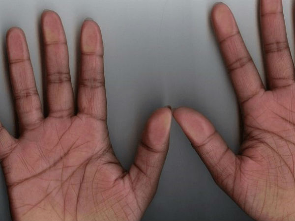 बहुत चौड़ी हथेली