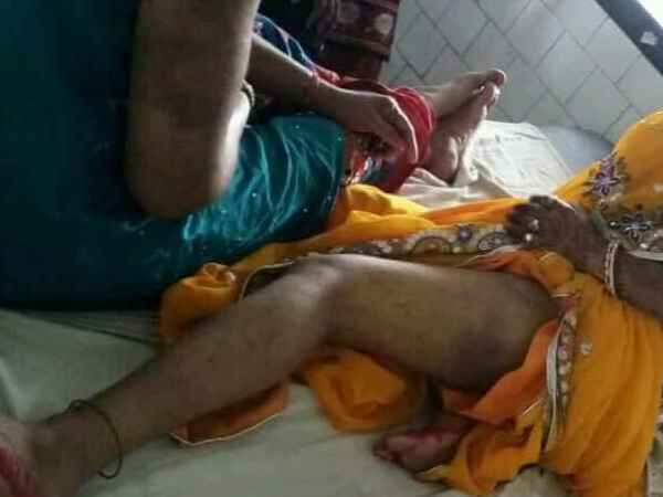 जख्म देखकर दुल्हन को भेजा अस्पताल