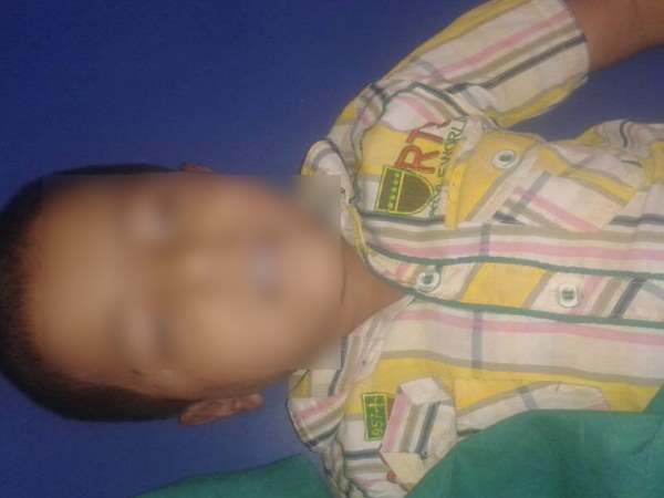 एक परिवार को फल खाना पड़ा महंगा, दो छोटे बच्चों की मौत