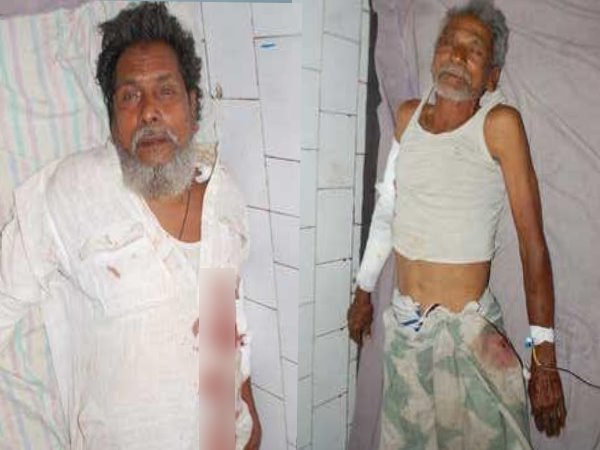 रंगदारी न देने पर सांसद के घर बम से हमला, 4 लोगों की हालत गंभीर